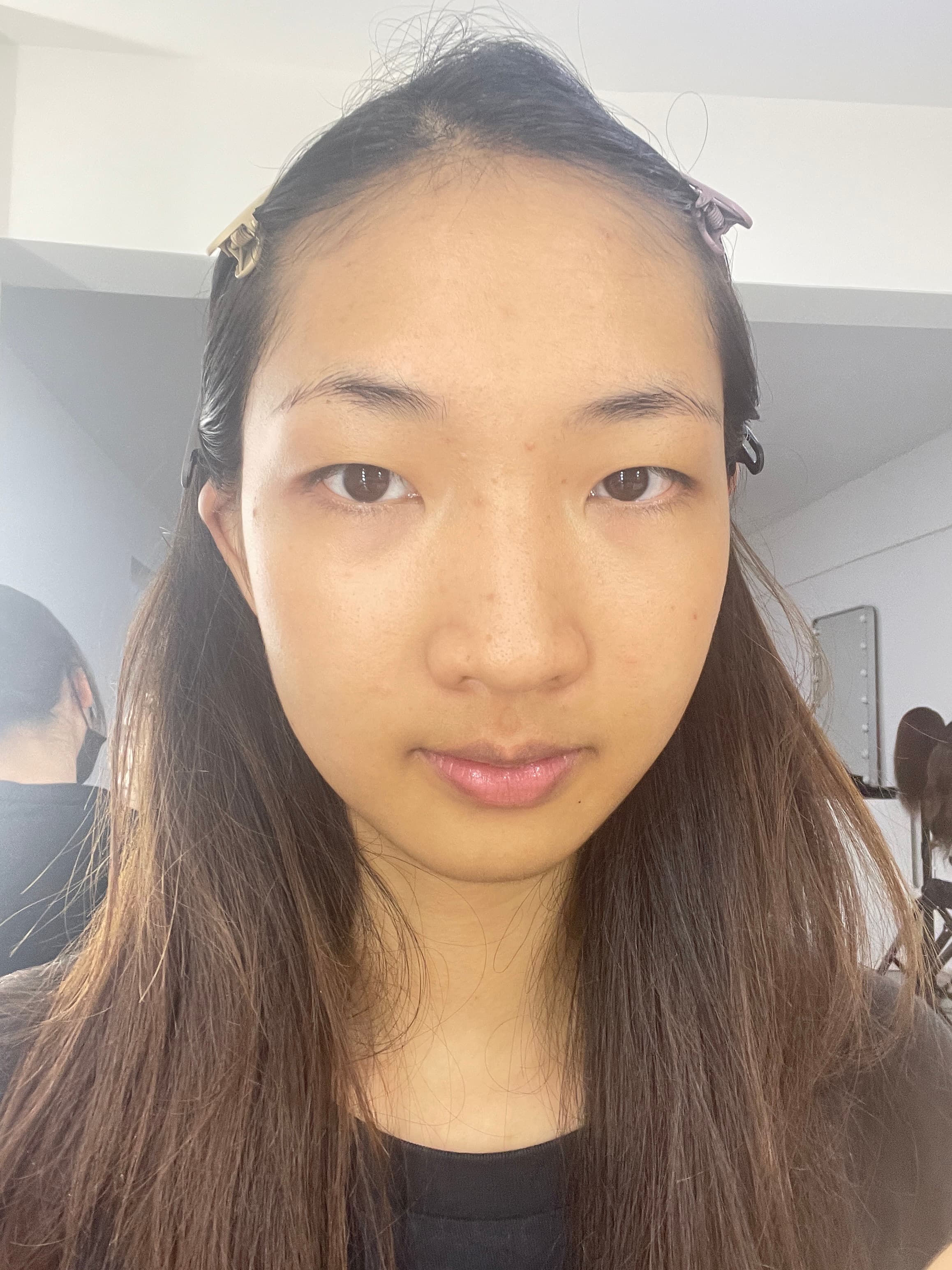 Before and After before 1