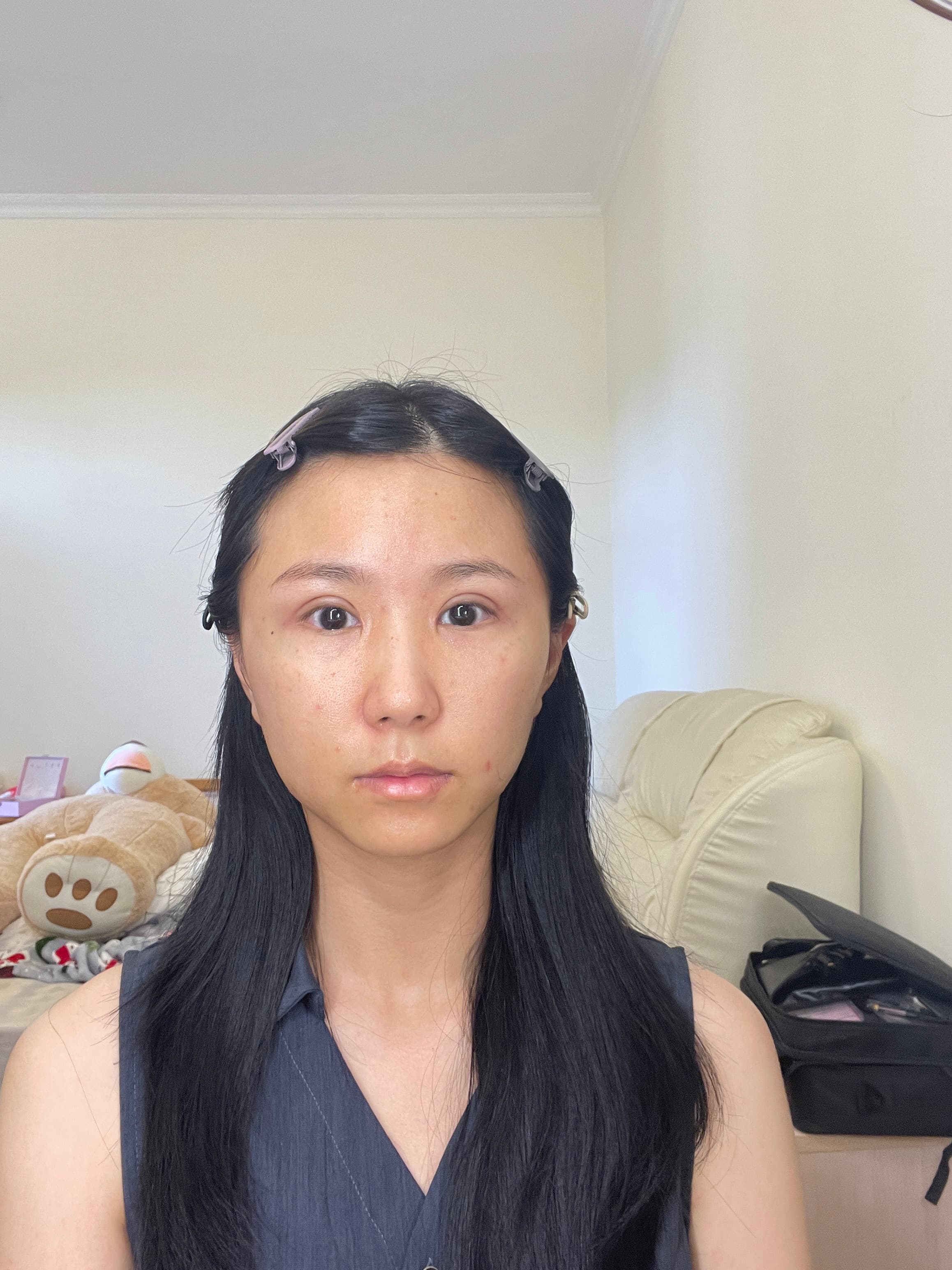 Before and After before 10