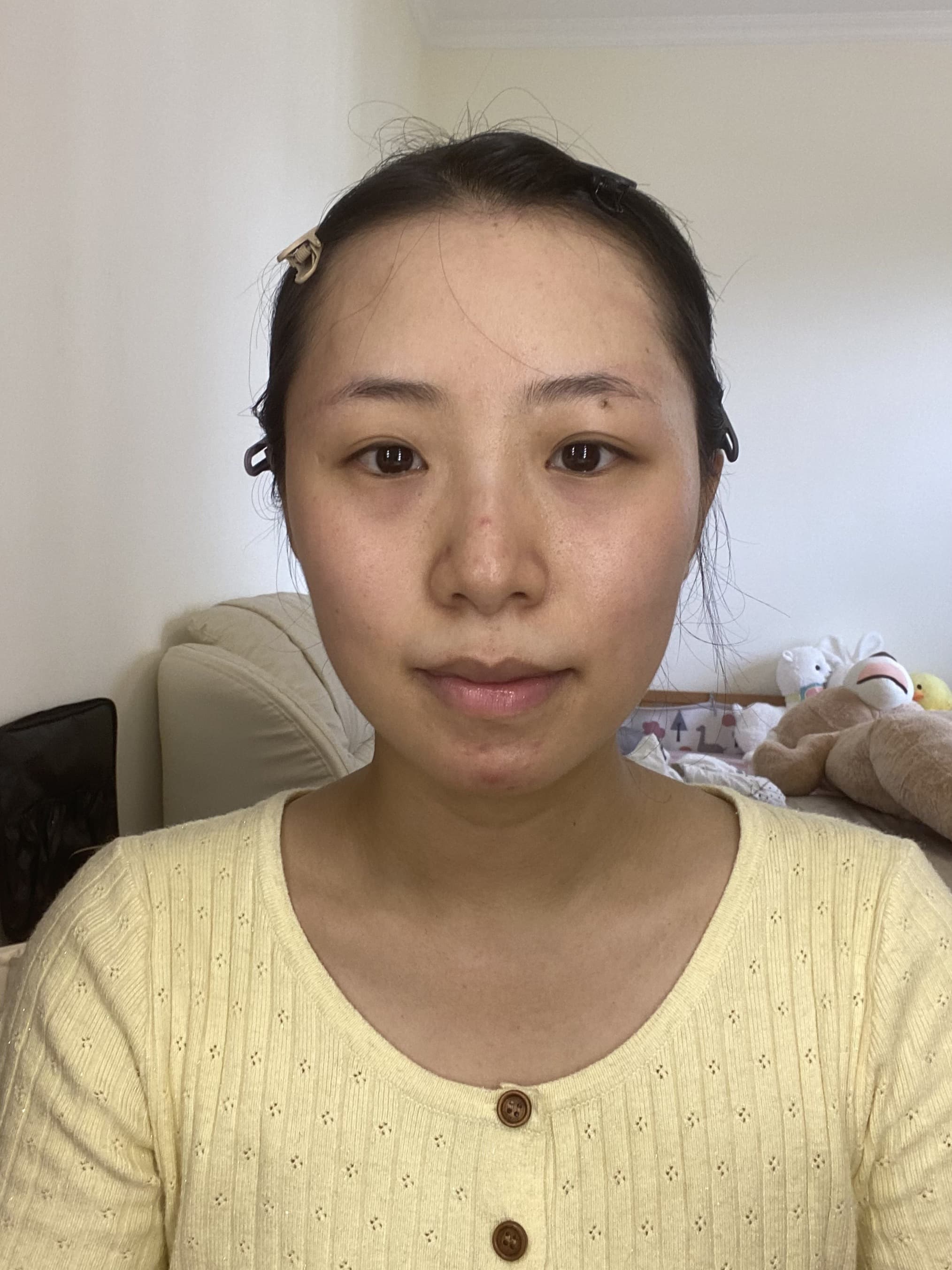 Before and After before 12