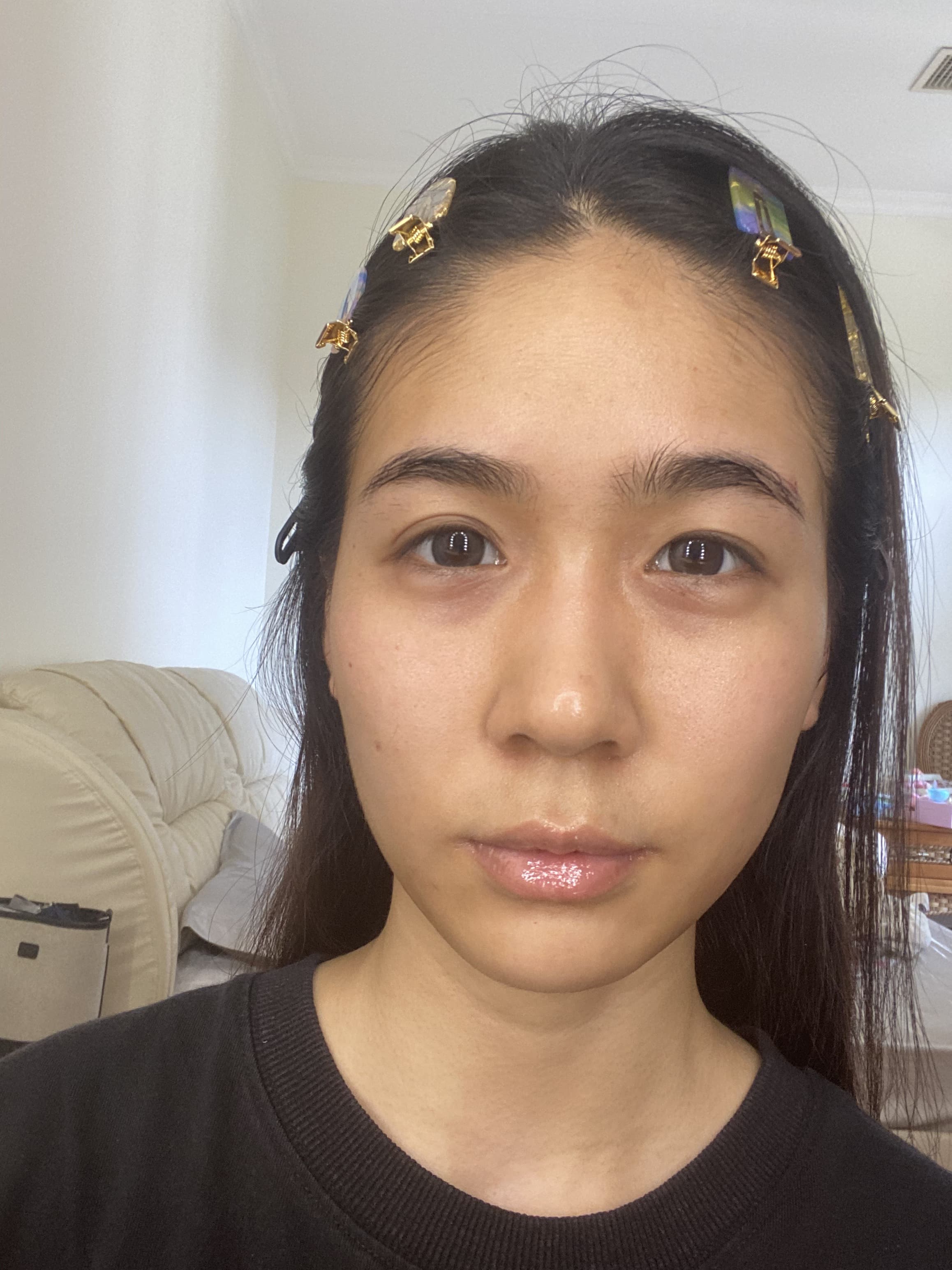 Before and After before 13